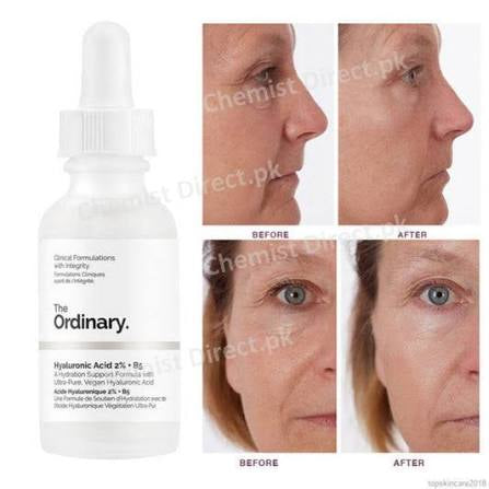 The Ordinary- Hyaluronic Acid 2%+ B5
