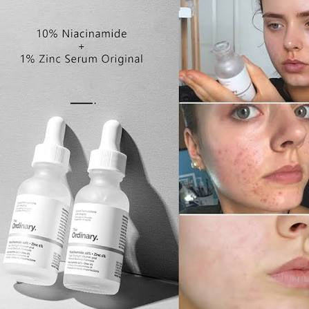 The Ordinary - Niacinamide 10%+ Zinc 1%