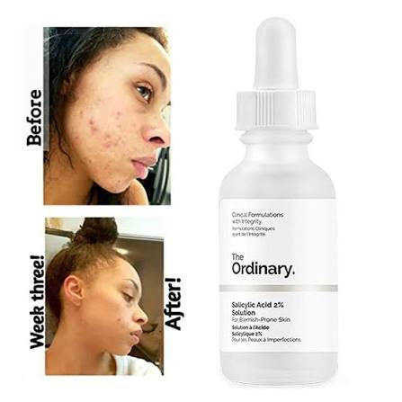 The Ordinary - Salicylic Acid 2% Acne Solution